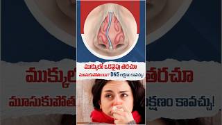 Deviated Nasal Septum Causes And Symptoms | Nose Blockage Treatment Details | Asian ENT Care Centre