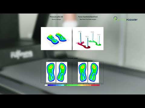Improve Your Running Or Walking Technique With A Zebris Running Room Gait Analysis