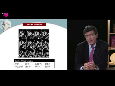 EACVI free webinar: 3D Echo - State of the Art in 2017