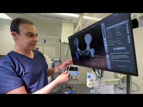 SMART Robotic Surgeon ™ | Patient “Bespoke” Pre-Operative Plan