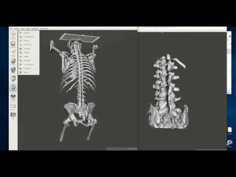 Explore The Best Editable Bone Model Printouts Online