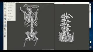 Advanced Free 3D Printable Bone Creation: Creating and Processing Multiple Models from a CT Scan