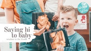 The journey to five | Saying hi to baby | Window to the womb