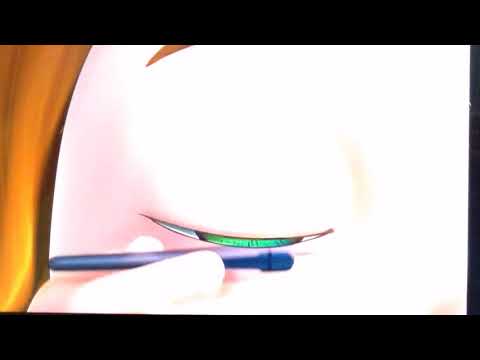 TooToo Boy Opening Vs TooToo Girl Opening Side-By-Side Comparison