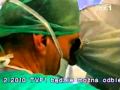 08 12 2009 TVP1 Pierwsza W Europie Wschodniej Operacja Wstrzepienia Implantu Hybrydowego Osobom Z Ni
