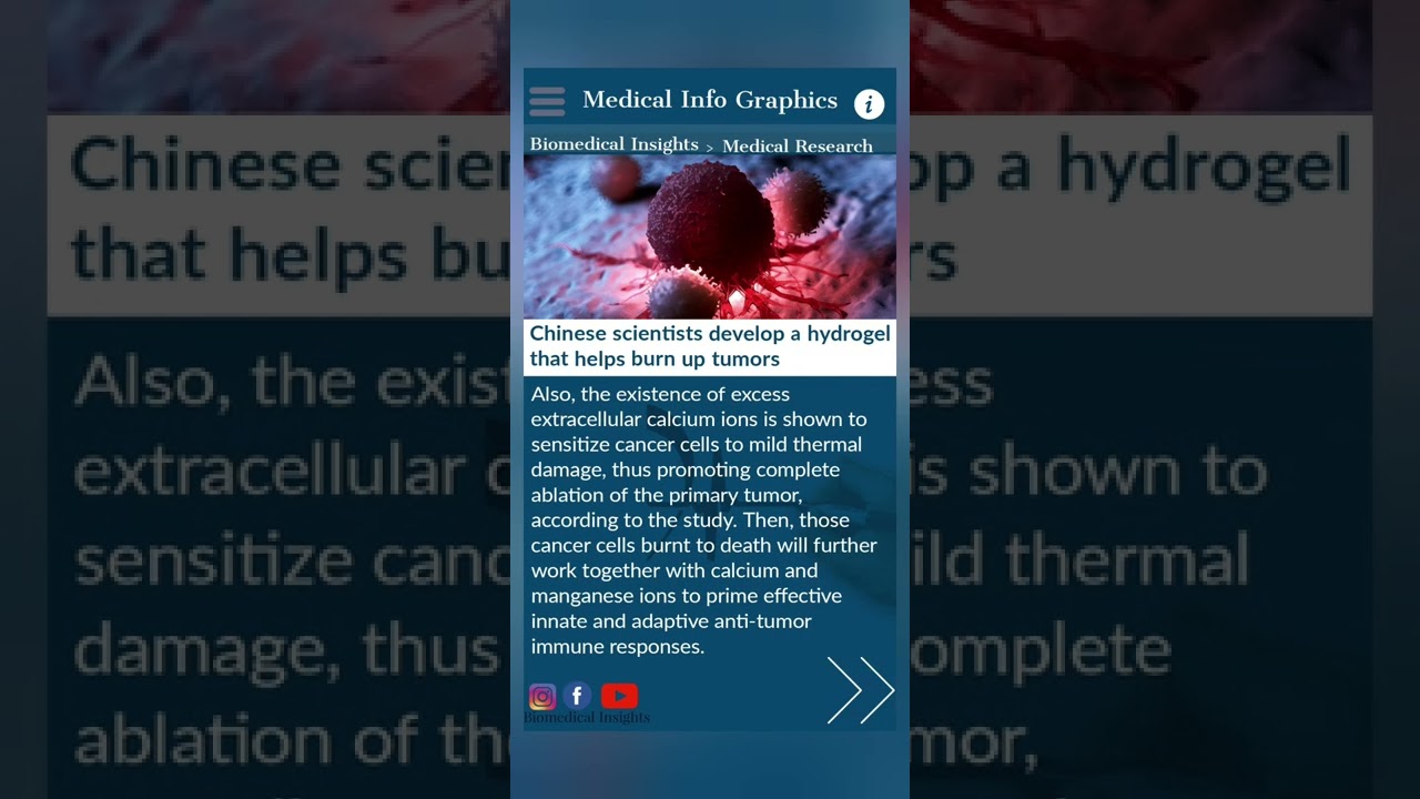 Chinese scientists develop a hydrogel that helps burn up tumors