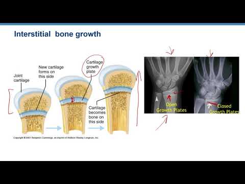 Video Lecture Ex 8, Regions of the Epiphyseal Plate