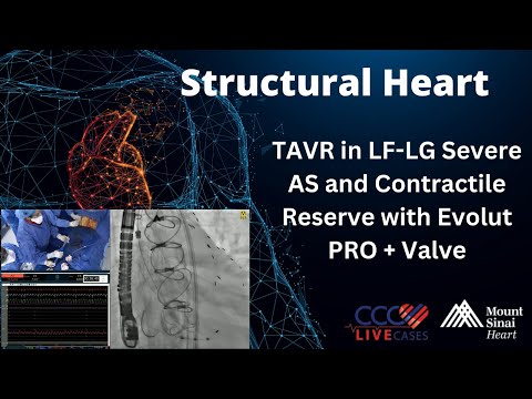 TAVR in LF-LG Severe AS and Contractile Reserve with Evolut PRO + Valve