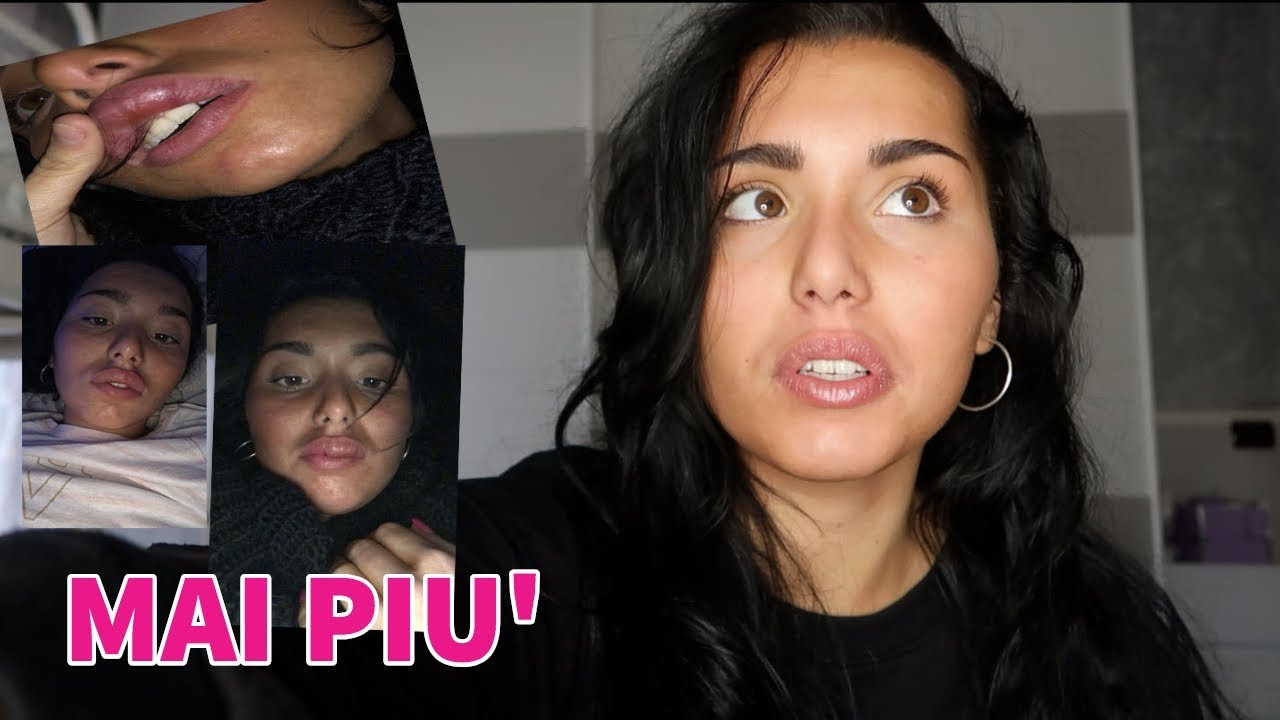 COSA È SUCCESSO AL MIO LABBRO! *assurdo*