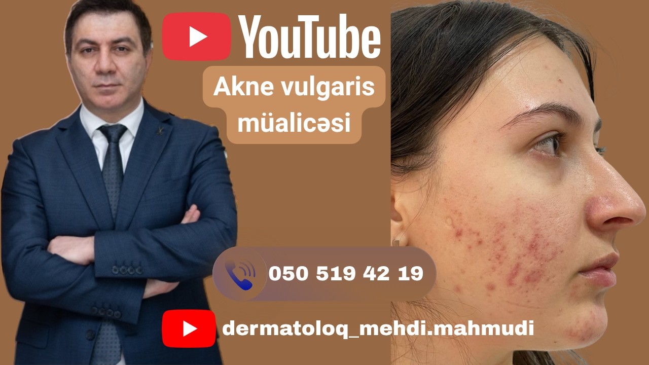 Dermatoloq Mehdi Mahmudi