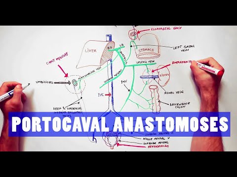 Portocaval Anastomoses - ANATOMY Tutorial