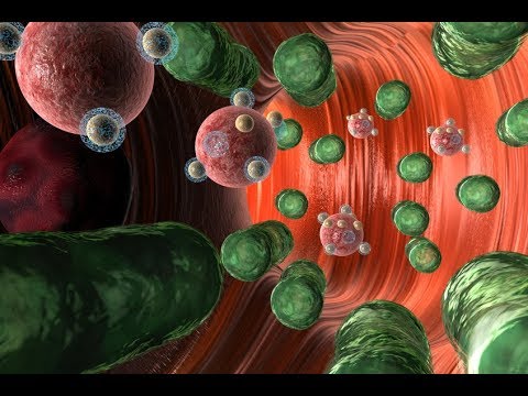 Wirksames Analgesie Gelenk Schmerzen in der linken Seite des Rückens und der Arm