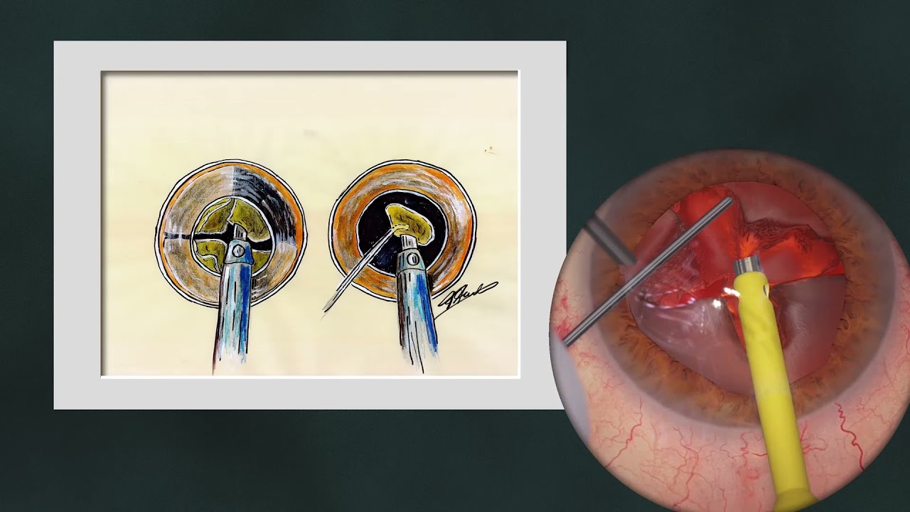 Dr. Med. Univ. Florian Auerbach Febo, Mhba-15