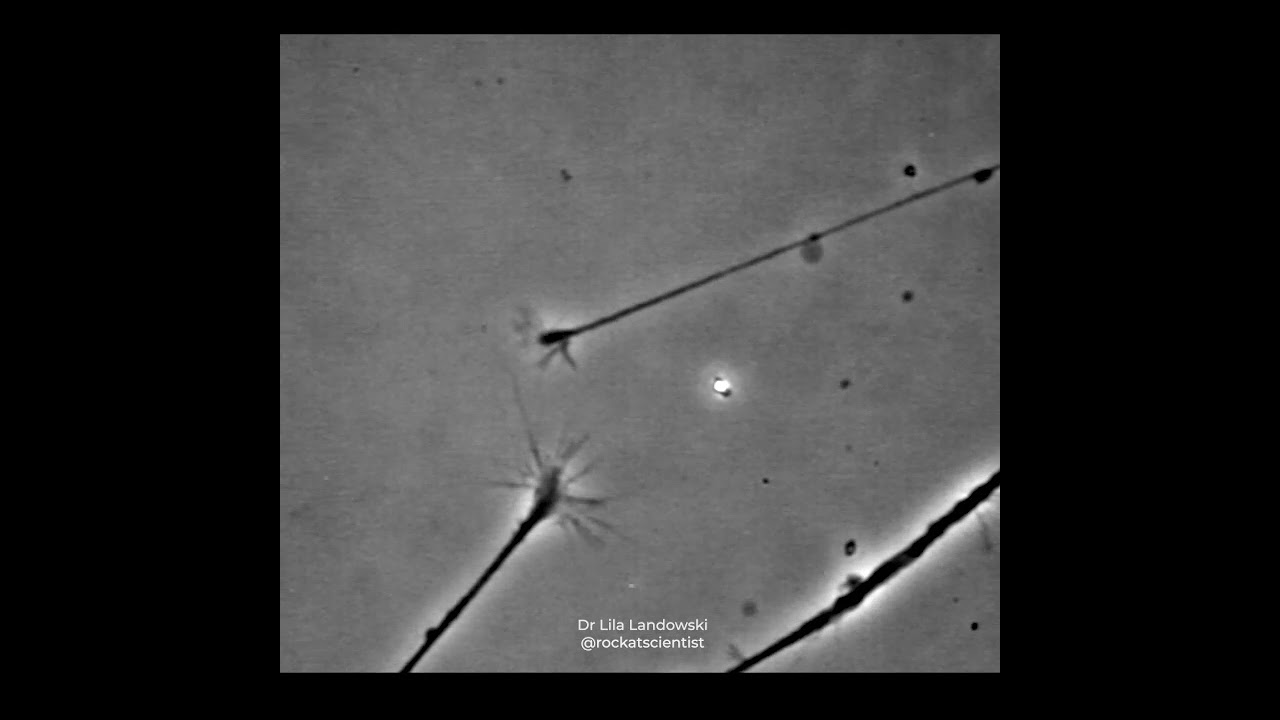 FINDING THAT CONNECTION © - Neurons connecting in a petri dish - growth cones sensing one another