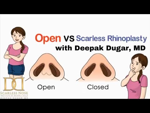 What is a Closed Rhinoplasty "Scarless Nose" vs Open Rhinoplasty? by Dr. Deepak Dugar, Beverly Hills