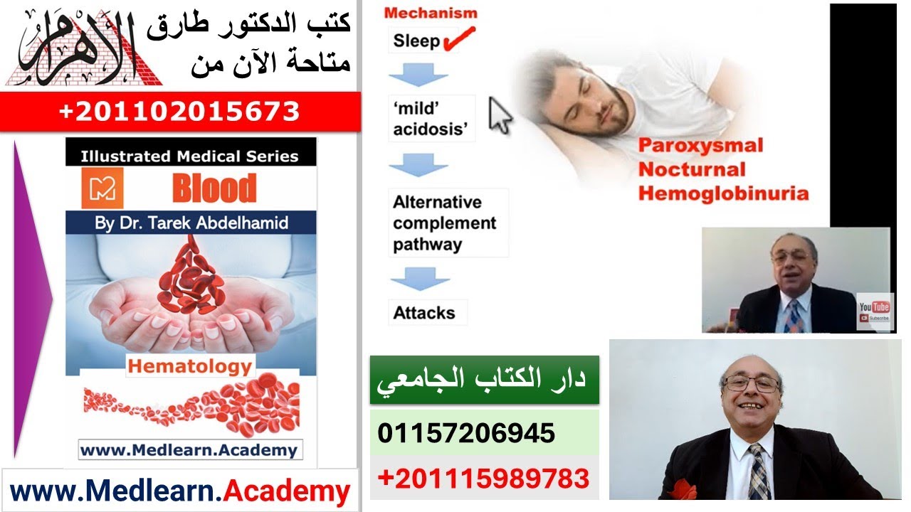 Paroxysmal Nocturnal Hemoglobinuria (PNH)   #cme #internal_medicine #medical   #usmle #محاضرات_باطنة