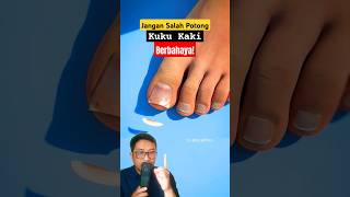 Download lagu Don't Cut Your Toenails Wrongly. It's Dangerous! #shorts #education #science #nails mp3 Download lagu Don't Cut Your Toenails Wrongly. It's Dangerous! #shorts #education #science #nails mp3