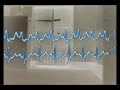 Brian Eno - Alternative 3 (Clinic Graphs - 2nd version)
