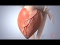 Symptoms of Sudden Cardiac Arrest | Cedars-Sinai
