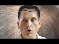 Stealing Millions For Plastic Surgery Matthew Cox