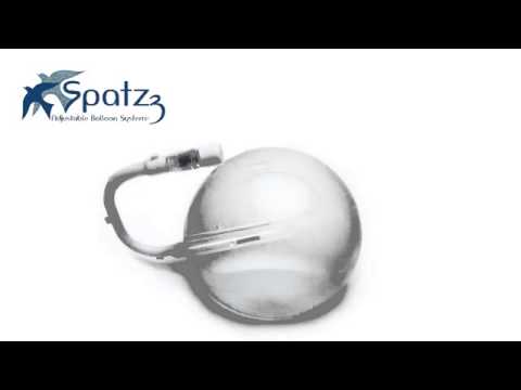 Adjustable Spatz 3 Gastric Balloon