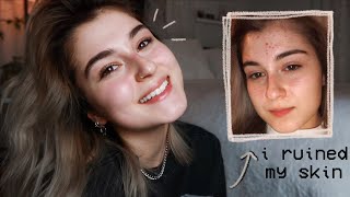 how i cleared my skin *after ruining it* UPDATED SKINCARE ROUTINE!