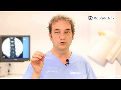 Tratamiento de la hernia de disco lumbar