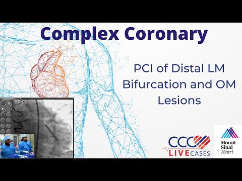 PCI of Distal LM Bifurcation and OM Lesions - March 9, 2010 Webcast Video
