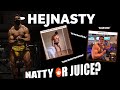 Reacting to my NATTY OR JUICE threads