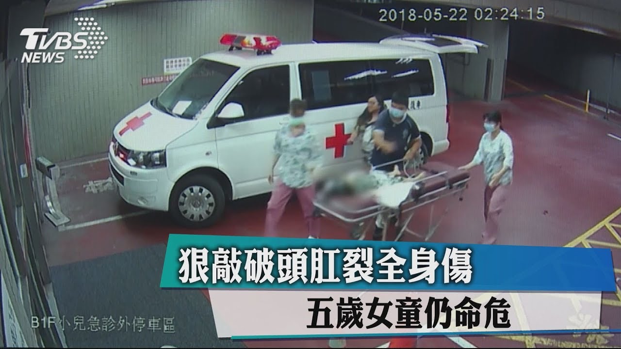狠敲破頭肛裂全身傷　5歲女童仍命危