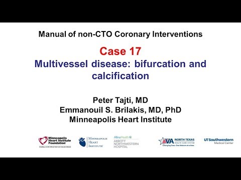 Case 17: PCI Manual: bifurcation and calcification