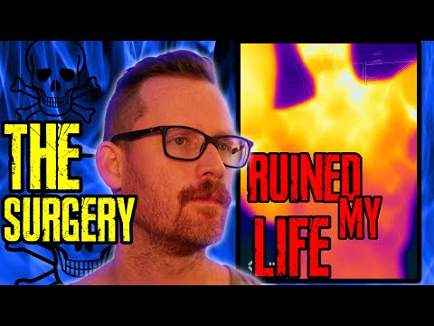 The Surgery that Ruined My Life - ETS Surgery - Sympathectomy