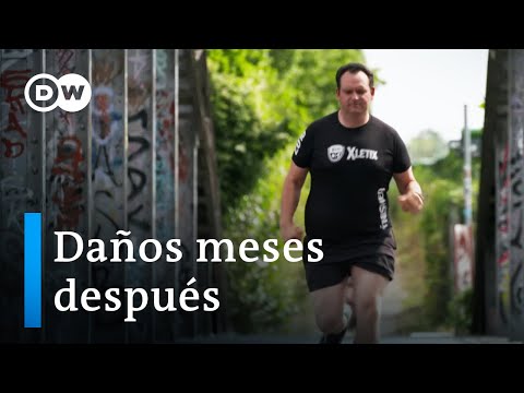 Secuelas de la COVID-19 | DW Documental