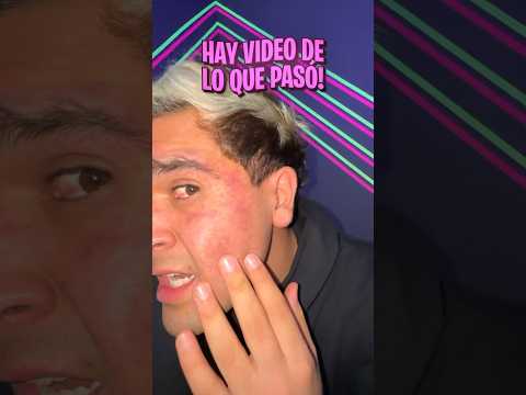 No van a creer lo que me pasó en la cara😭🤯😱😪