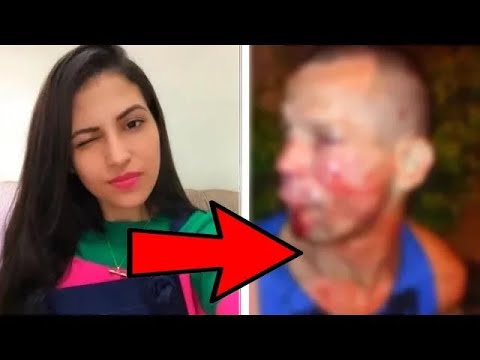 Sie hatte ein Unfall der für immer ihr Gesicht entstellte. Als es ihr Mann  erfuhr, geschah das 😨