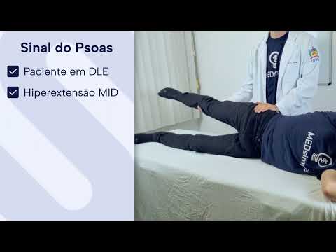 Sinal do Psoas - Exame Físico do Abdome