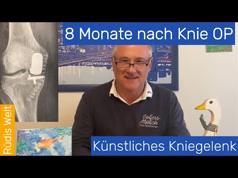 8 Monate nach Knie-OP - Künstliches Kniegelenk nach Arthrose - Oxfordschlitten