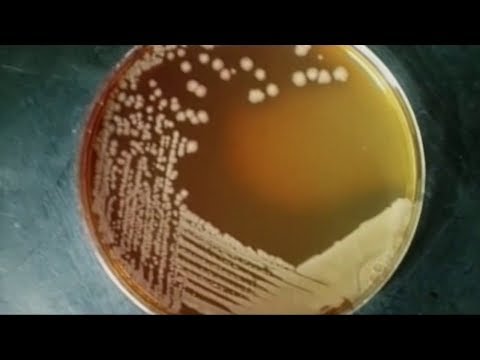 Long Beach, New York E — Coli Contaminated Water Update