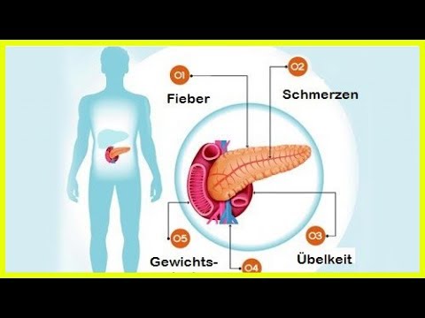 6 Symptome bei Erkrankungen der Bauchspeicheldrüse