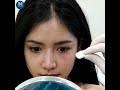 โบท็อก
