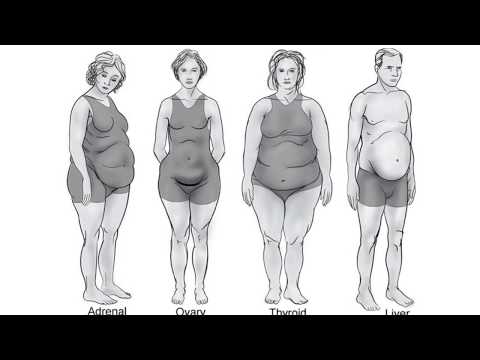 The Answer To Obesity Is In The Food Statistics – Dr Berg