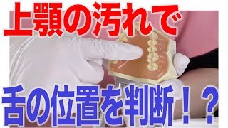 上顎の汚れと舌の位置は関係ある？マルかバツか？