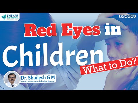 Sudden onset Red Eyes in Children: Causes, Treatments & When to See a Doctor? | Shekar Eye Hospital