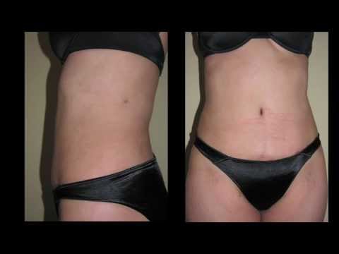 Plastic Surgeon