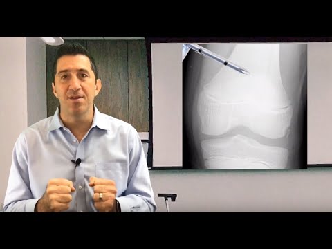 Handtevy Minute: It's Time to Squash the Tibial IO