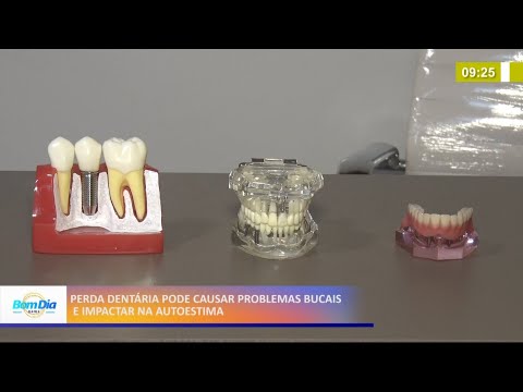 Perda dentária pode causar problemas bucais e impactar na autoestima 13 04 2021