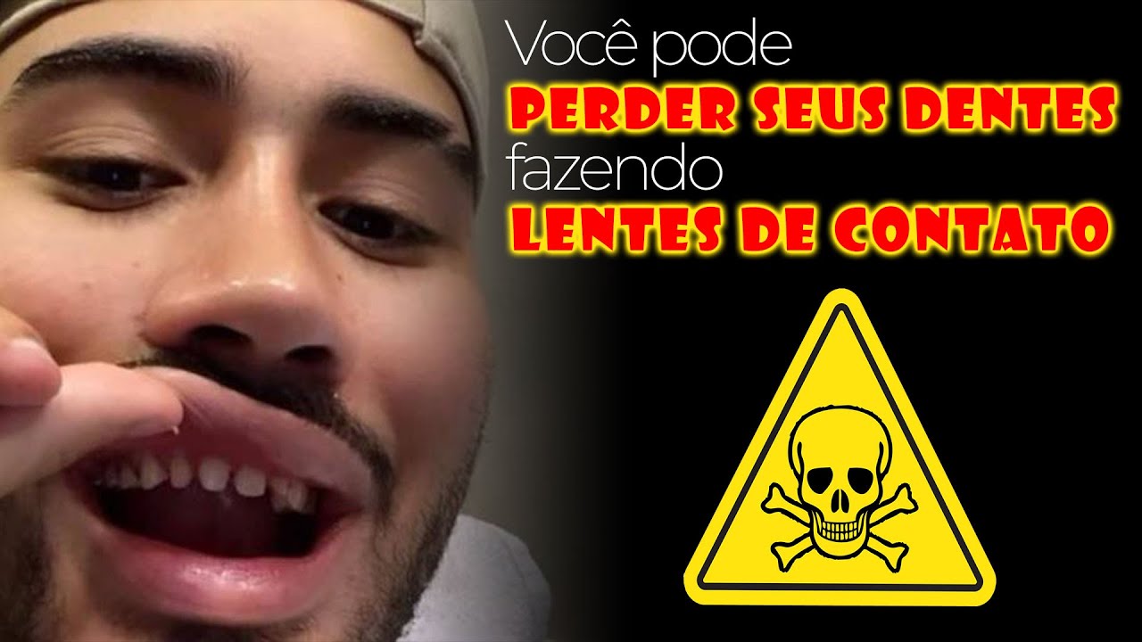 Você pode PERDER seus DENTES fazendo LENTES DE CONTATO DENTAIS! Assista até o fim para entender...