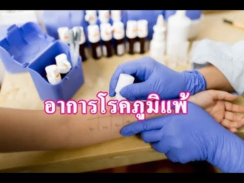 ดร. ไทคิดเห็นโรคสะเก็ดเงิน คนที่มีโรคสะเก็ดเงิน