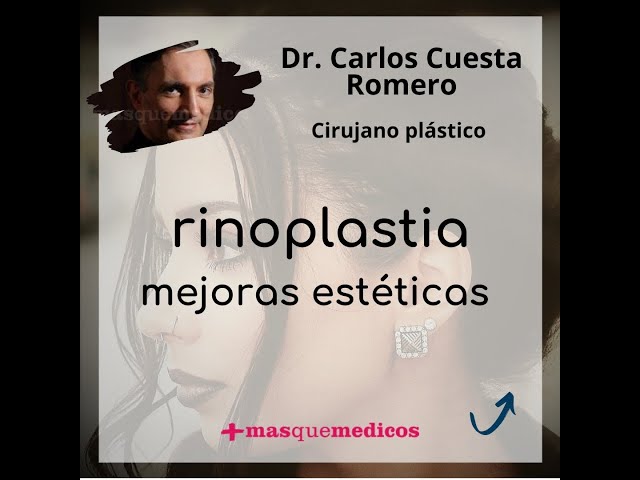 Rinoplastia estética - Doctor Carlos Cuesta Romero