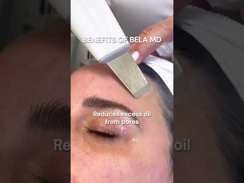 What are the benefits of Bela MD treatment? 🌼 #facialtreatment #medicalgradeskincare #medispa